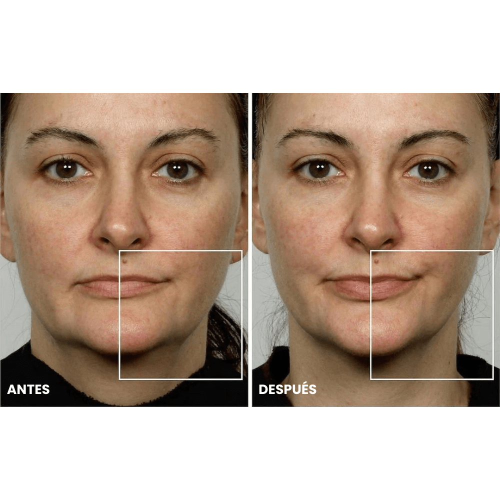 Care - Dispositivo Microcorriente Facial