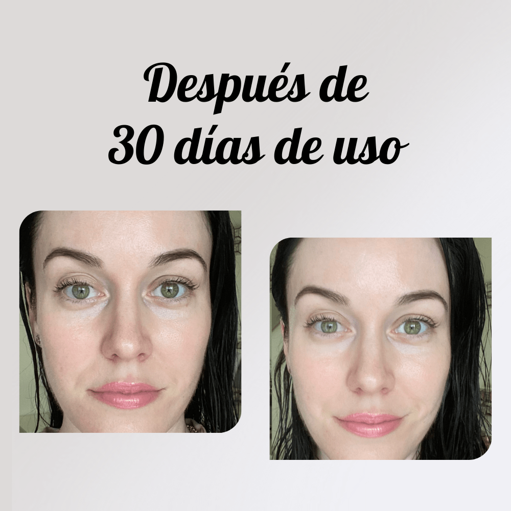 Beauty Bar - Descongestionador Facial